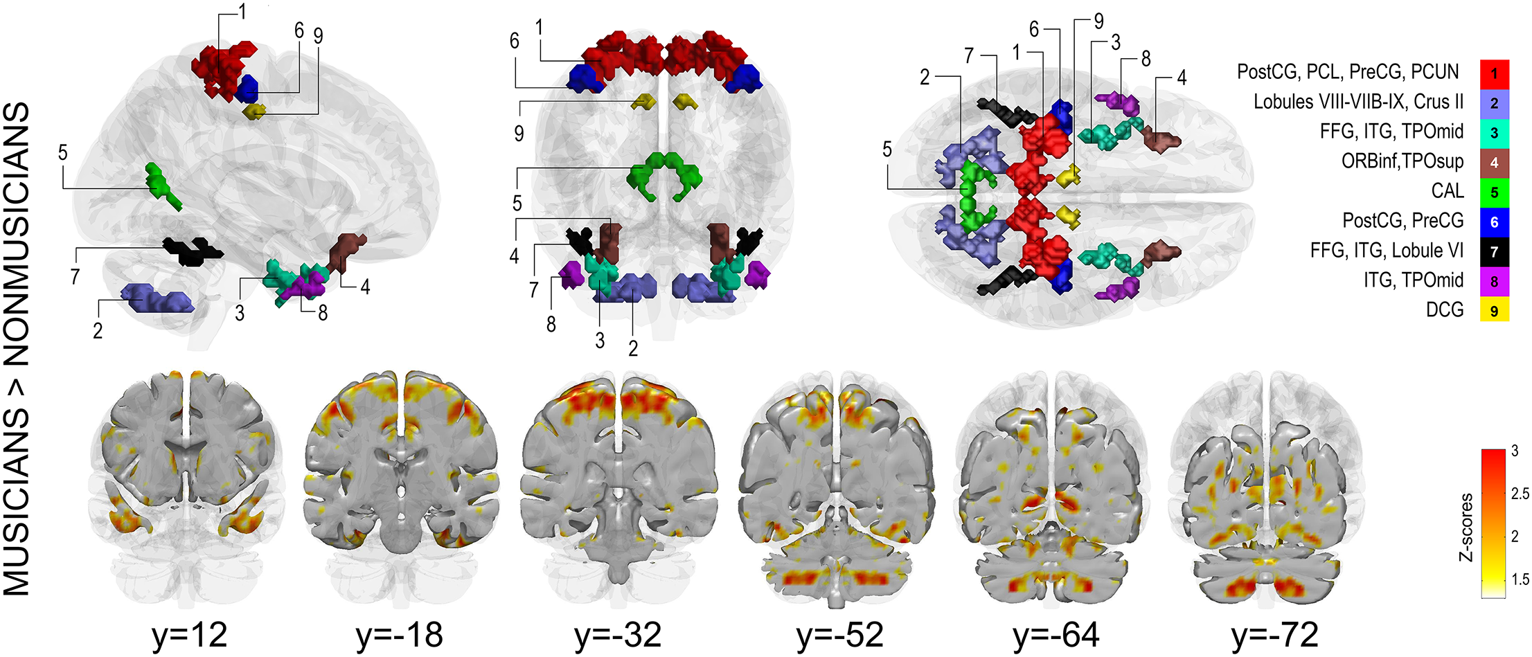 Functional brain-imaging results from Burunat and colleagues’ music-listening study